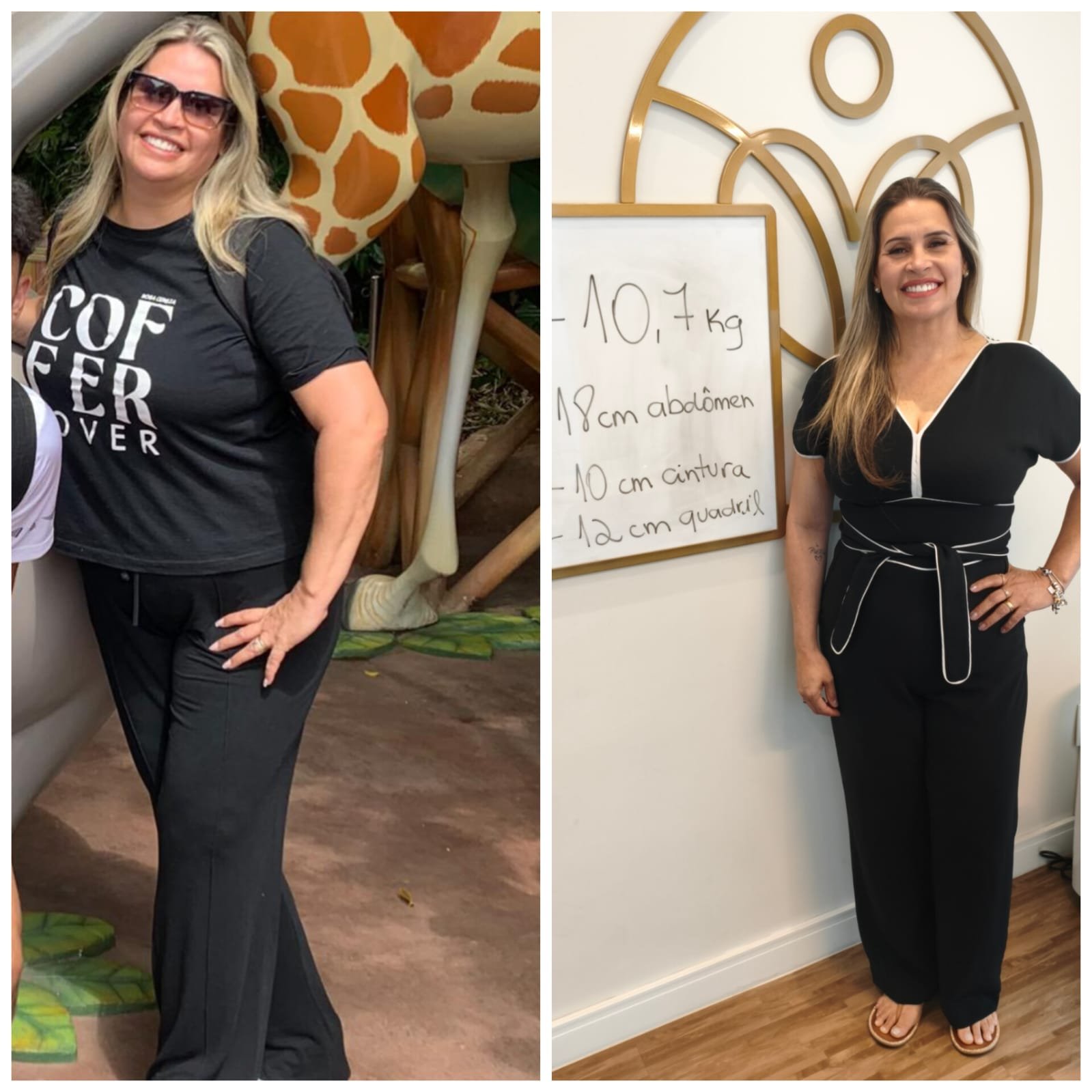 Antes e Depois - Adriana